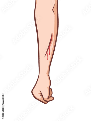 Bleeding scar or wound on arm hand skin vector illustration isolated on vertical white background. Blood on wound drawing with simple flat outlined art style.