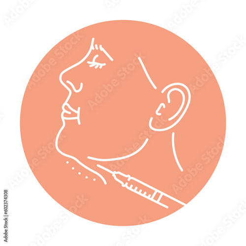 Lipolytic injections into the chin color line illustration