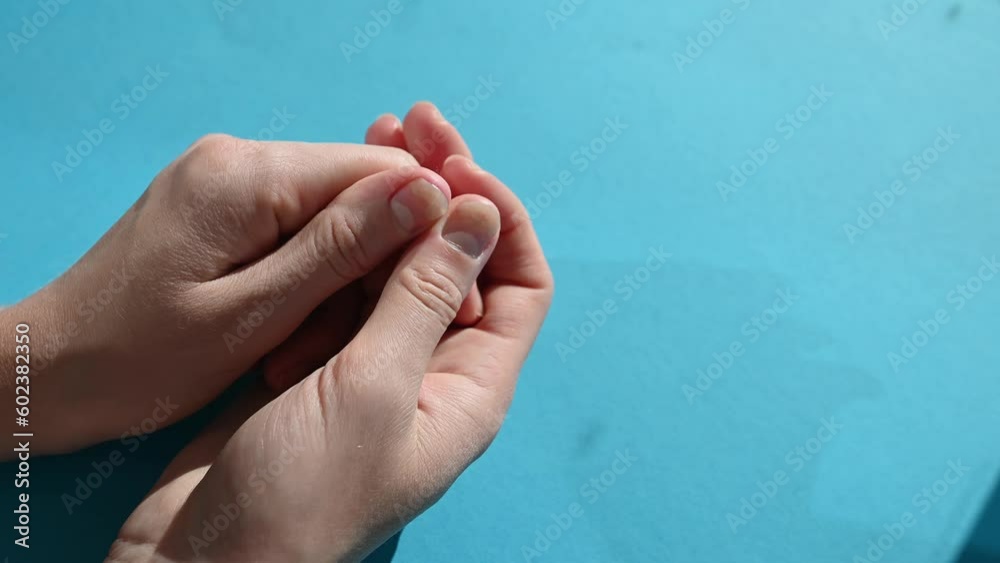 Hands with nail lesions - onycholysis,on a blue background.Separation of the nail plate from the nail bed after manicure Hands with nail lesions - onycholysis,on a blue background.Separation of the nail plate from the nail bed after manicure