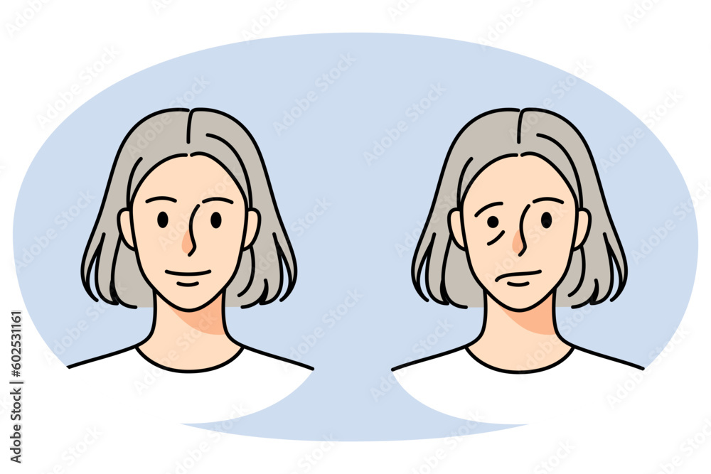 Old woman struggle with facial nerve palsy Old woman struggle with facial nerve palsy
