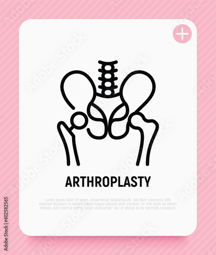 Arthroplasty thin line icon, artificial joint, surgical procedure to restore joint. Arthritis. Vector illustration.