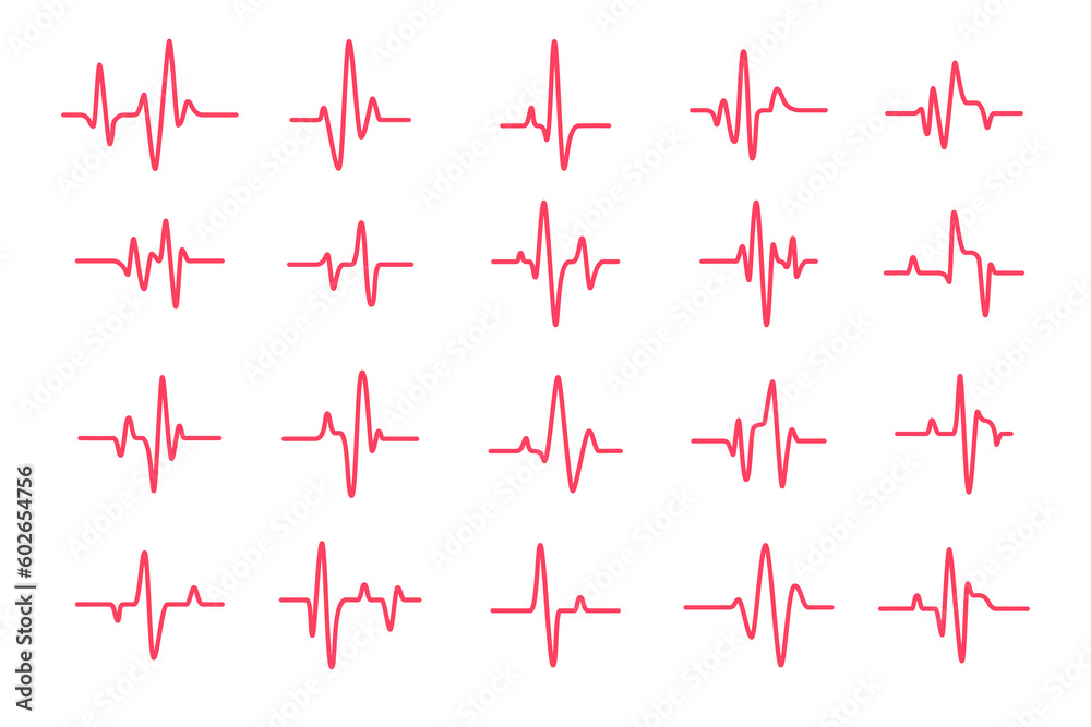heart rhythm graph Checking your heartbeat for diagnosis
