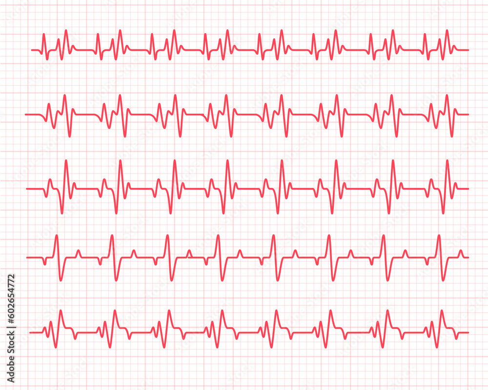 heart rhythm graph Checking your heartbeat for diagnosis heart rhythm graph Checking your heartbeat for diagnosis