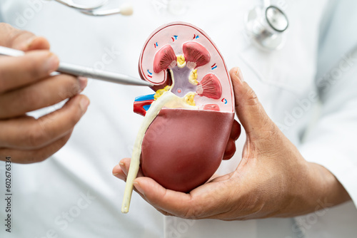 Kidney disease, Chronic kidney disease ckd, Doctor hold model to study and treat in hospital.