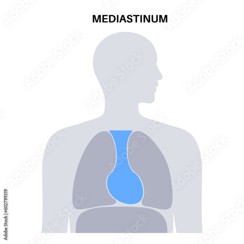 Mediastinum infographic poster