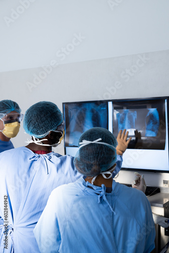 Diverse group of surgeons discussing x rays on screen in operating theatre, copy space