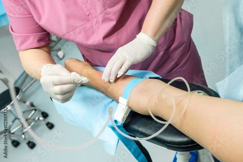 The doctor in sterile gloves wipes the patient's hand with an alcohol solution before installing the dropper catheter.