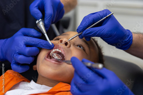 Close up of dentists working on teeth of a little boy
