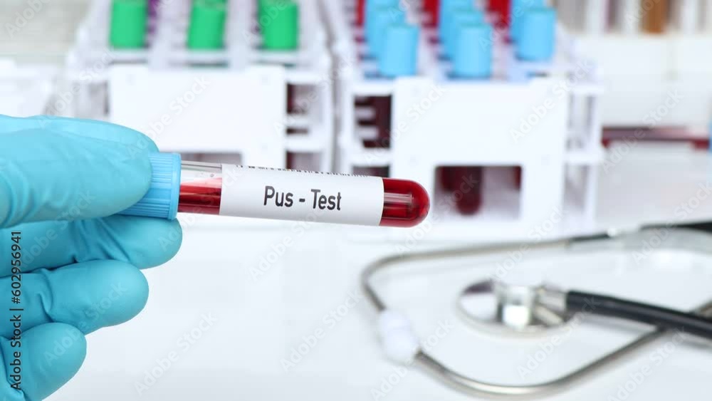 Pus test, blood sample to analyze in the laboratory, blood in test tube Pus test, blood sample to analyze in the laboratory, blood in test tube
