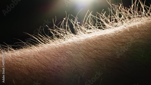 Hand skin texture hair goosebumps close-up. Hairy goose bumps Arm surface macro shooting. Body and healthcare, hygiene and medicine concept. photo