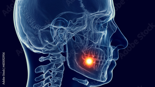 3d medical illustration of a man's skull and cervical spine. tooth ache