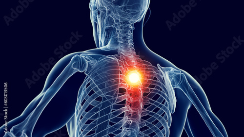 3d medical illustration of a man's thoracic spine. back pain