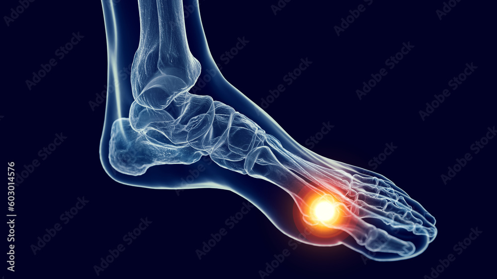 3D Rendered Medical Illustration of foot pain. 3D Rendered Medical Illustration of foot pain.