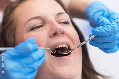 close up young woman receiving dental treatment from a qualified dentist using dental tools in a modern dental clinic. 