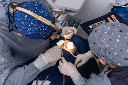 A cosmetic surgeon uses a nasal retractor to hold back a flap of skin tissue while cutting with a pair of dorsal scissors. Open rhinoplasty and tip plasty procedure.
