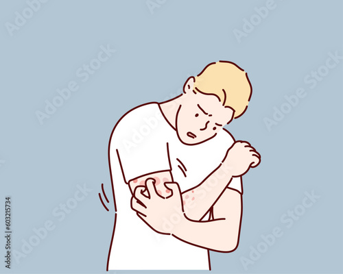 Young man scratching arm. Guy suffering from strong allergy skin itchy symptom in flat design. Red rash skin irritation. Hand drawn style vector design illustrations. photo