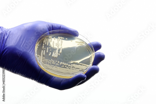 Gloved medical or scientific hand, with a microbiological culture of Candida auris yeast, an antimicrobial-resistant pathogen. 