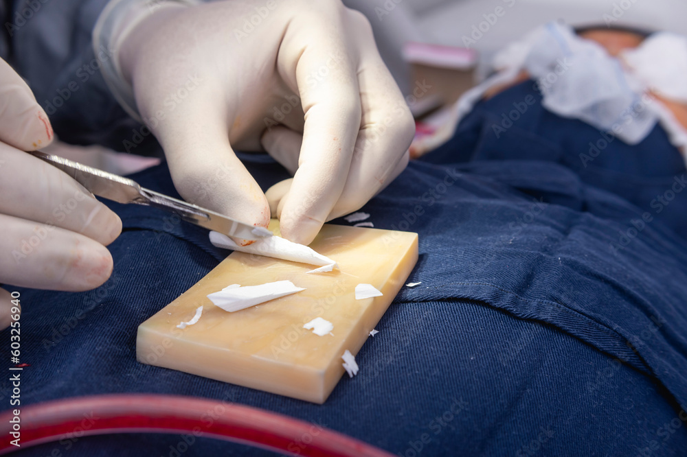 A cosmetic surgeon cuts and shapes a piece of ePTFE on a board. To be