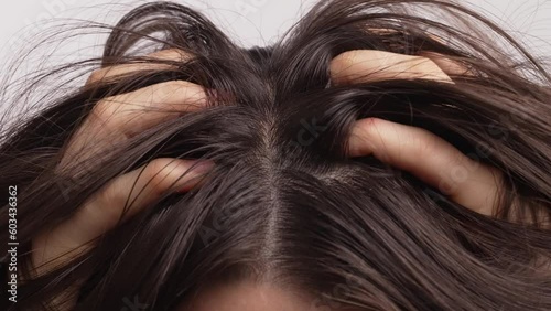 Young woman scratches irritated scalp