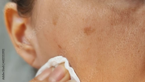 A woman rubs her skin with a sponge. Pigmented spots on the face. Care procedures, lotion. Close-up video. photo
