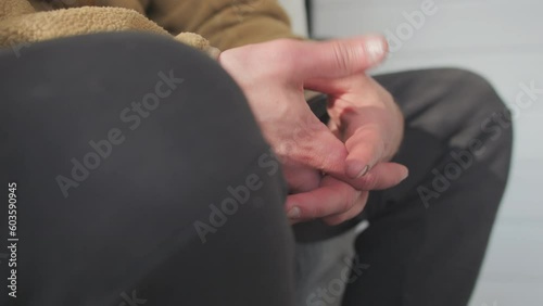 Man twiddle his thumbs while sitting, close up view