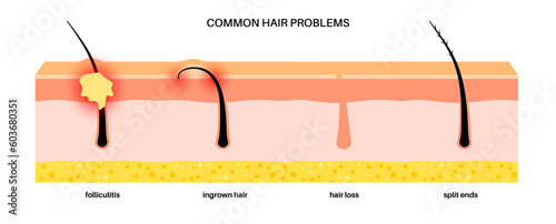 Common hair problems