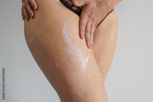 White woman's legs with flab and cellulite