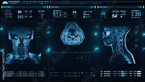 
Medical Profile of Patient Showing Neck MRI Scan. Animation Showing Top, Front, Lateral View. Vital Signs and Several Healthcare Information Charts and Data. Diagnosis Medical Data. photo