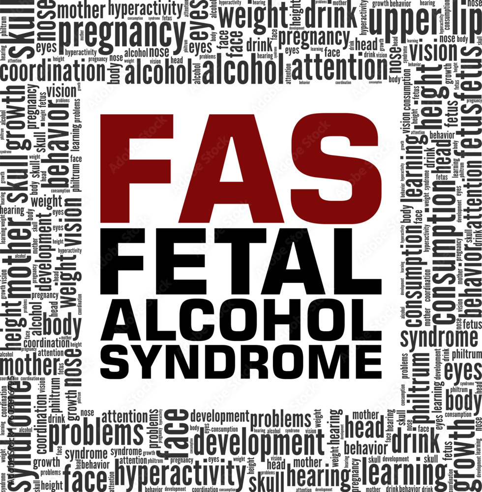 Obraz premium FAS - Fetal Alcohol Syndrome word cloud conceptual design isolated on white background.