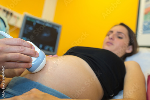 Valokuva concept of an ultrasound consultation