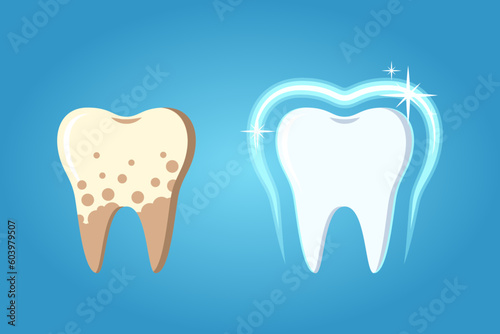 Difference between treated teeth and teeth with plaque photo
