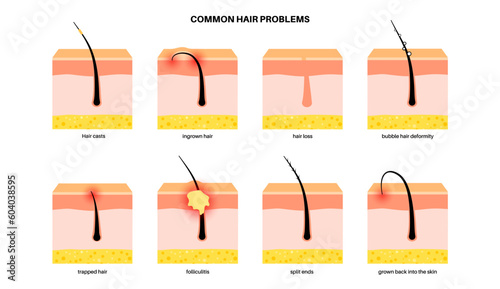 Common hair problems