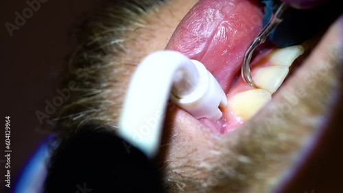 Dental cleaning at dentist office, dental hygienist