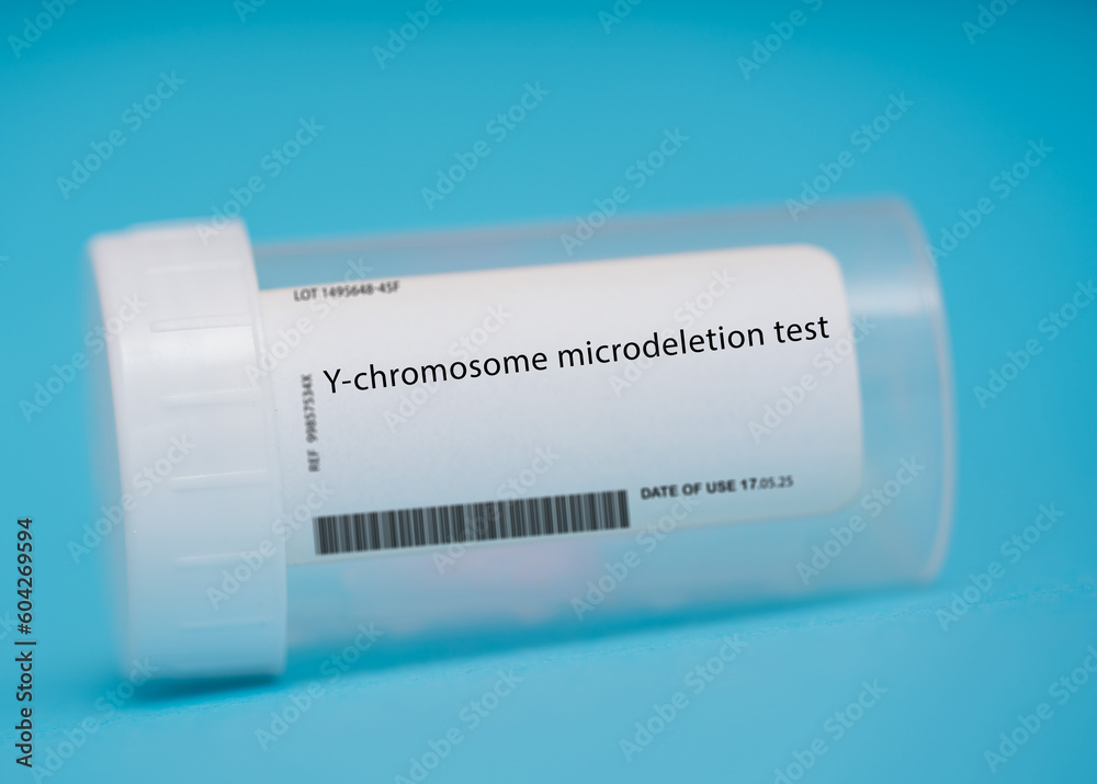 Y-chromosome microdeletion test Y-chromosome microdeletion test