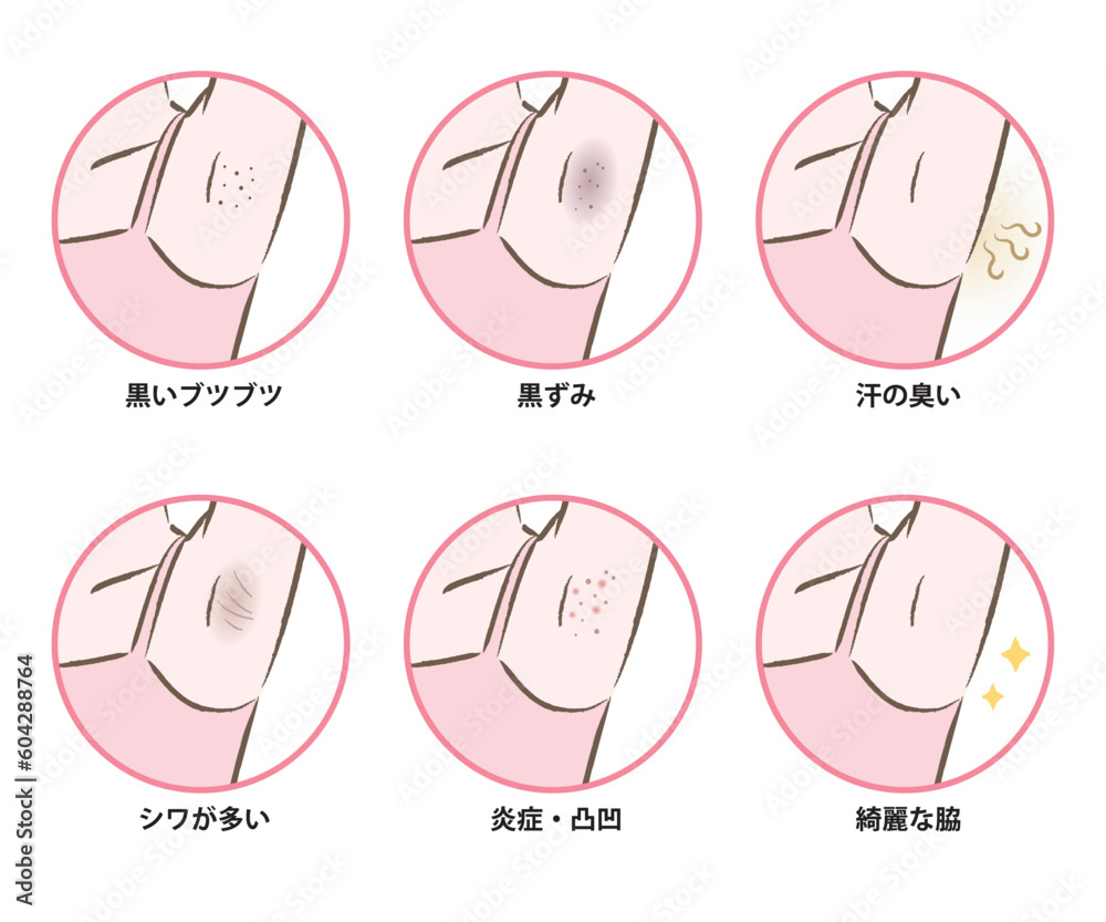 ワキの悩みに関するイラストセット くすみ、シワ、ブツブツ、汗の臭い ワキの悩みに関するイラストセット くすみ、シワ、ブツブツ、汗の臭い