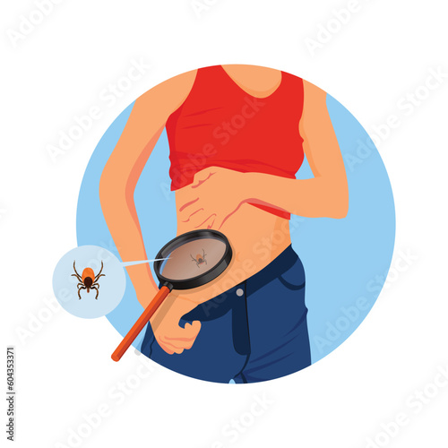 Removing encephalitis ticks after bite. How to remove mite. Parasite carrying disease.Woman opening underwear to find ticks.