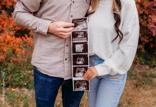 couple with baby sonogram photo