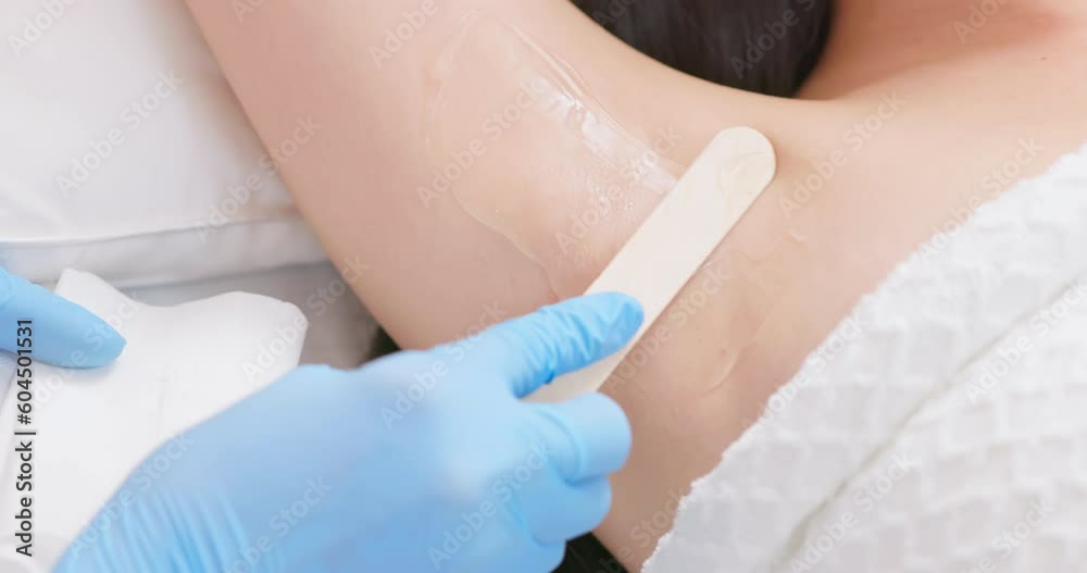 laser hair removal preparation laser hair removal preparation