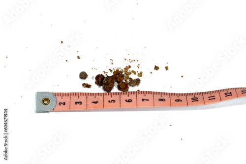 Nephrolithiasis, irregular brown kidney stones (renal calculus or nephrolith), the stones are different in size after operative ureteroscopy and Laser Lithotripsy and fragmentation, selective focus photo