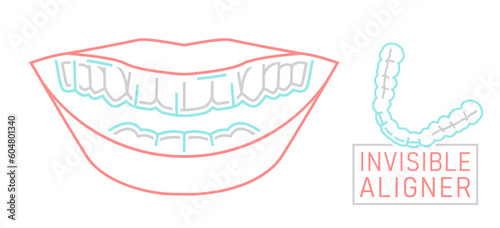 Orthodontic silicone trainer. Invisible braces aligner, retainer.