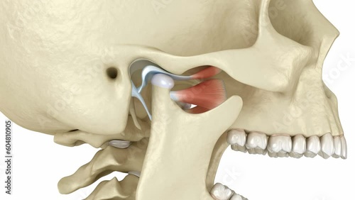 Temporomandibular joints and dislocated articular disc. Medically accurate 3D animation