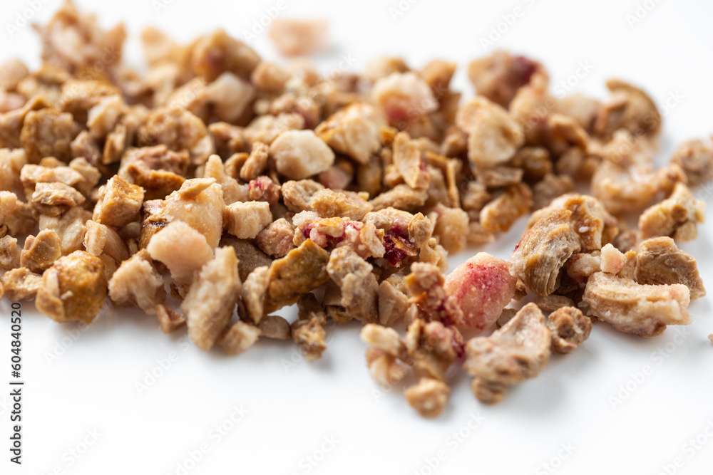 Kidney stones. Stones were removed from the patient's kidneys Kidney stones. Stones were removed from the patient's kidneys