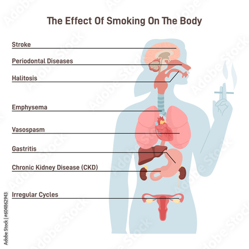 Diagram about health effect of cigarette smoking. Illustration about risk of smokers.