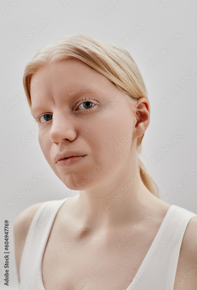 Vertical portrait of ethereal girl with albinism looking at camera against white Vertical portrait of ethereal girl with albinism looking at camera against white