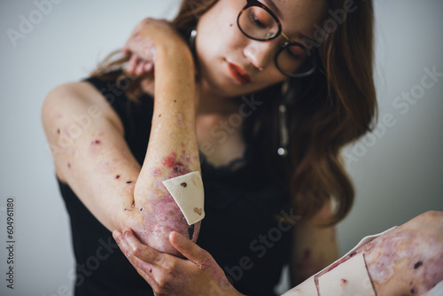 Photos 白い背景で堂々と自分を表現する皮膚の難病をもつ女性