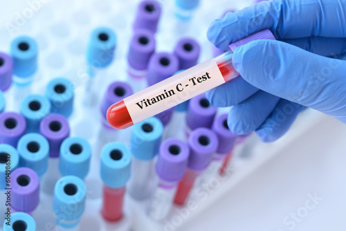 Doctor holding a test blood sample tube with Vitamin С test on the background of medical test tubes with analyzes.Banner.Copy space for text photo