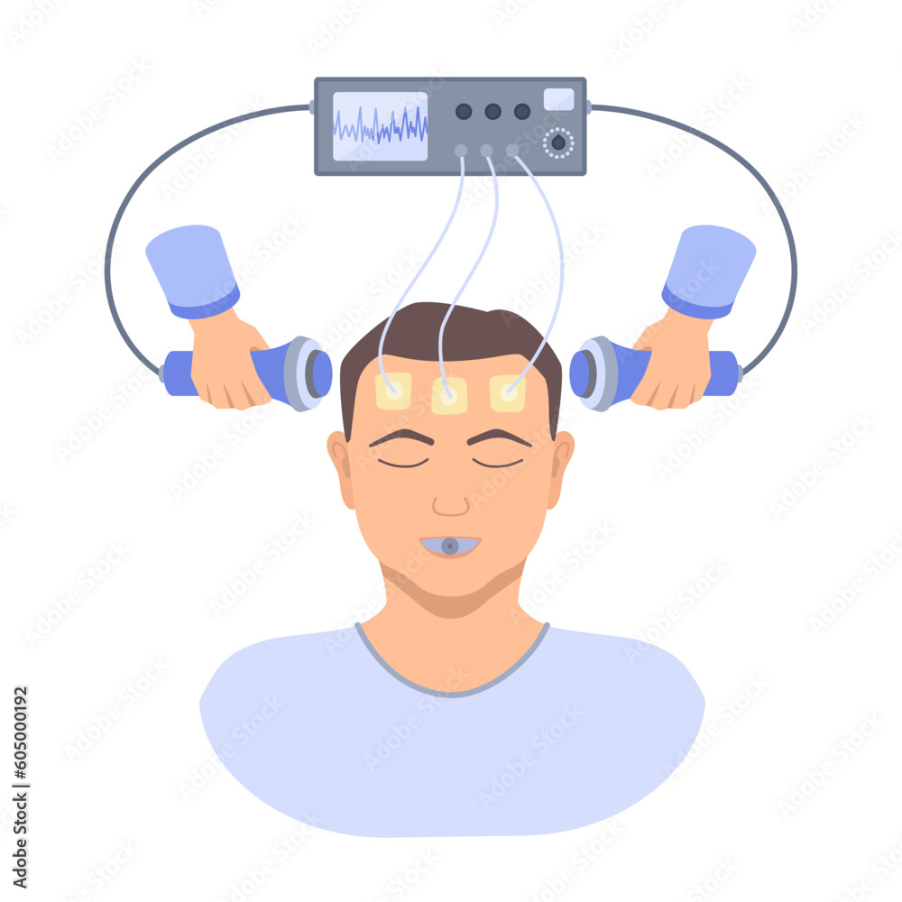 Electroconvulsive therapy for severe depression treatment. ECT electrodes placement on male patient. Brain stimulation equipment for bipolar and major depressive disorders. Vector medical illustration Electroconvulsive therapy for severe depression treatment. ECT electrodes placement on male patient. Brain stimulation equipment for bipolar and major depressive disorders. Vector medical illustration