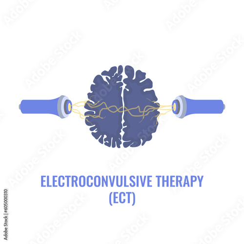 Electroconvulsive therapy for severe depression and schizophrenia treatment. ECT electrodes placement. Brain stimulation equipment for bipolar and major depressive disorders. Vector illustration.