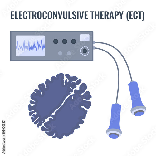 Electroconvulsive therapy for severe depression and schizophrenia treatment. ECT electrodes placement. Brain stimulation equipment for bipolar and major depressive disorders. Vector illustration.