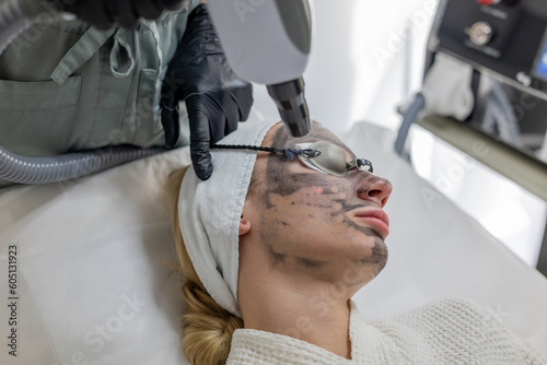 Beautician performs a carbon fiber based skin exfoliation treatment. The cosmetologist administers the carbon face peeling procedure, utilizing specialized equipment for effective results.